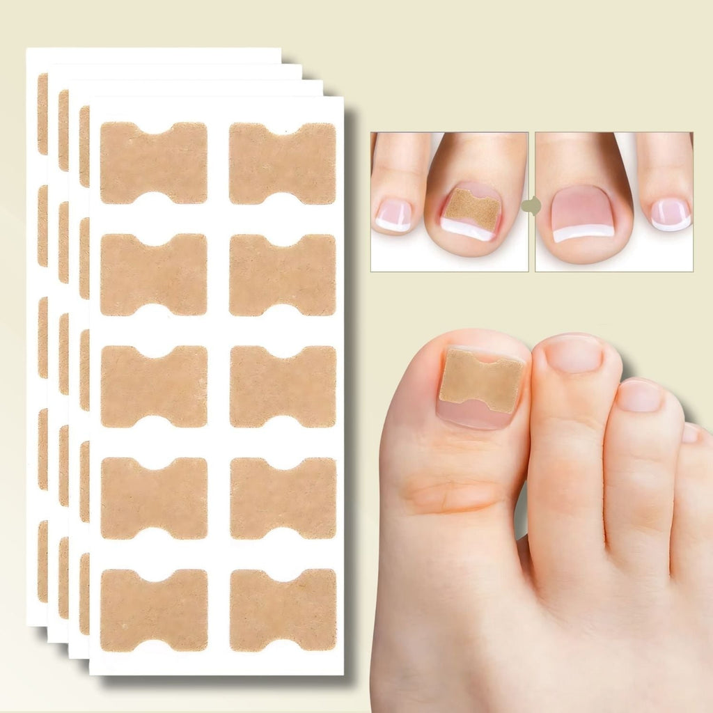 Ingrown Toenail Corrector Patches Elastic Adhesive Peel and Stick 10 Pack - Image 1