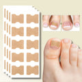 Ingrown Toenail Corrector Patches Elastic Adhesive Peel and Stick 10 Pack - Image 1
