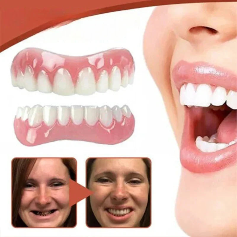 Snap on Veneers with Moldable Thermal Beads and Storage Case for Custom Fit - Image 4